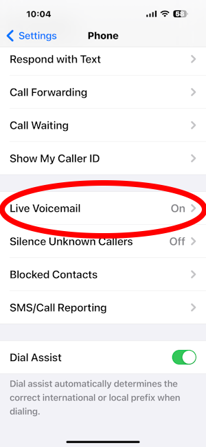 live voicemail